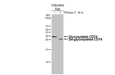Anti-CD74 antibody [HL3636] used in Western Blot (WB). GTX641627