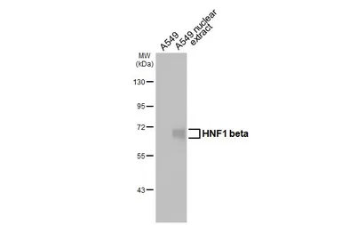 Anti-HNF1 beta antibody [HL3639] used in Western Blot (WB). GTX641630