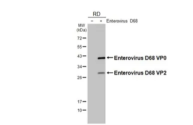 Anti-Enterovirus D68 VP2 antibody [HL3641] used in Western Blot (WB). GTX641632