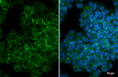 Anti-CCR5 antibody [HL3650] used in Immunocytochemistry/ Immunofluorescence (ICC/IF). GTX641641