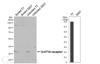 Anti-5-HT1A receptor antibody [HL3657] used in Western Blot (WB). GTX641648
