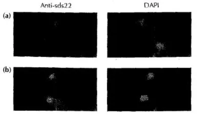 Anti-Sds22 (S. pombe) antibody used in Immunocytochemistry/ Immunofluorescence (ICC/IF). GTX64165