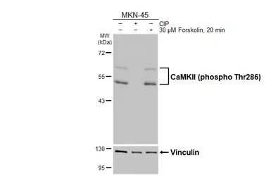 Anti-CaMKII (phospho Thr286) antibody [HL3662] used in Western Blot (WB). GTX641653
