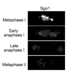 Anti-Shugoshin 1 (S. pombe) antibody used in Immunohistochemistry (IHC). GTX64167