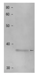 Anti-Shugoshin 1 (S. pombe) antibody used in Western Blot (WB). GTX64167