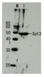 Anti-Spt3 (S. cerevisiae) antibody used in Western Blot (WB). GTX64168