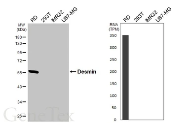 Anti-Desmin antibody [HL3667] used in Western Blot (WB). GTX641695