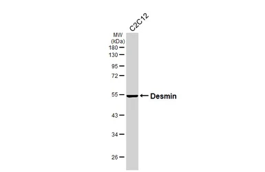 Anti-Desmin antibody [HL3667] used in Western Blot (WB). GTX641695