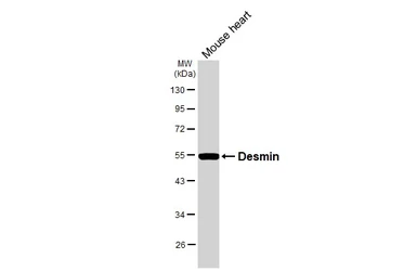 Anti-Desmin antibody [HL3667] used in Western Blot (WB). GTX641695