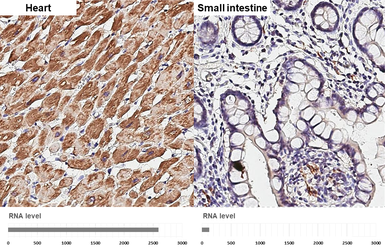 Anti-Desmin antibody [HL3668] used in IHC (Paraffin sections) (IHC-P). GTX641696