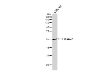 Anti-Desmin antibody [HL3668] used in Western Blot (WB). GTX641696