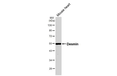 Anti-Desmin antibody [HL3668] used in Western Blot (WB). GTX641696