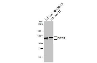 Anti-ORP8 antibody [HL3673] used in Western Blot (WB). GTX641701