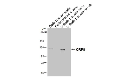 Anti-ORP8 antibody [HL3673] used in Western Blot (WB). GTX641701