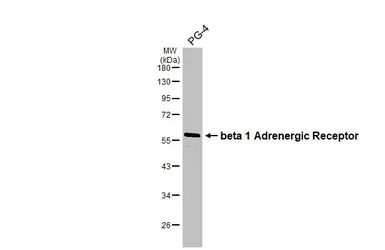 Anti-beta 1 Adrenergic Receptor antibody [HL3678] used in Western Blot (WB). GTX641706