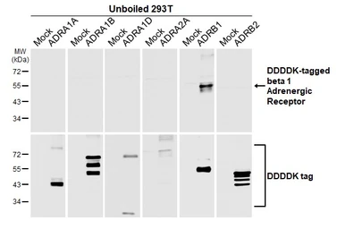 Anti-beta 1 Adrenergic Receptor antibody [HL3678] used in Western Blot (WB). GTX641706