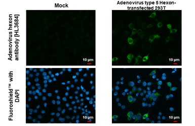 Anti-Adenovirus hexon antibody [HL3684] used in Immunocytochemistry/ Immunofluorescence (ICC/IF). GTX641712