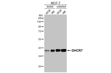 Anti-DHCR7 antibody [HL3685] used in Western Blot (WB). GTX641713