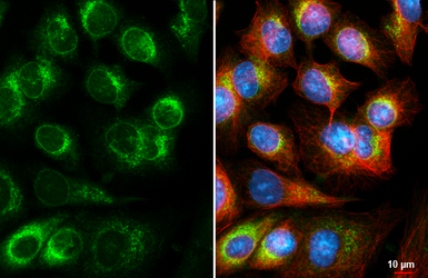 Anti-DHCR7 antibody [HL3685] used in Immunocytochemistry/ Immunofluorescence (ICC/IF). GTX641713