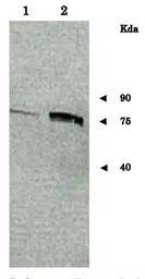 Anti-Sup35 / PSI+ (S. cerevisiae) antibody used in Western Blot (WB). GTX64173
