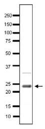 Anti-Taf10 (S. cerevisiae) antibody used in Western Blot (WB). GTX64175