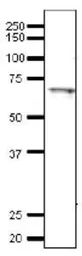 Anti-Tfa1 / TFIIEa (S. cerevisiae) antibody used in Western Blot (WB). GTX64183