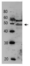 Anti-Tfg2 (S. cerevisiae) antibody used in Western Blot (WB). GTX64184