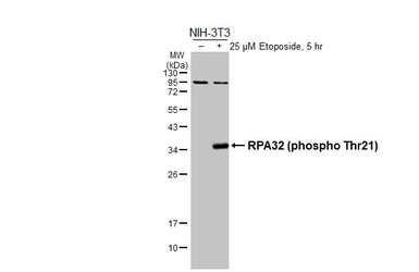 Anti-RPA32 (phospho Thr21) antibody [HL3693] used in Western Blot (WB). GTX641865