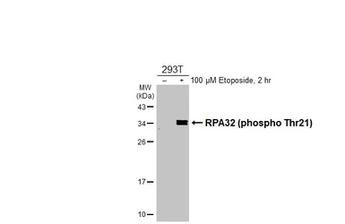 Anti-RPA32 (phospho Thr21) antibody [HL3693] used in Western Blot (WB). GTX641865