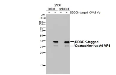 Anti-Coxsackievirus A6 VP1 antibody [HL3698] used in Western Blot (WB). GTX641870