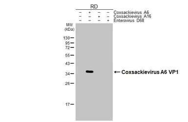 Anti-Coxsackievirus A6 VP1 antibody [HL3698] used in Western Blot (WB). GTX641870
