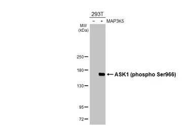 Anti-ASK1 (phospho Ser966) antibody [HL3701] used in Western Blot (WB). GTX641873