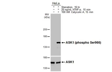 Anti-ASK1 (phospho Ser966) antibody [HL3701] used in Western Blot (WB). GTX641873