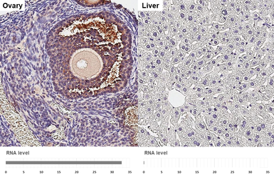 Anti-Thrombospondin 1 antibody [HL3704] used in IHC (Paraffin sections) (IHC-P). GTX641876