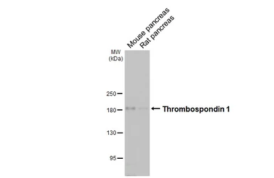 Anti-Thrombospondin 1 antibody [HL3704] used in Western Blot (WB). GTX641876