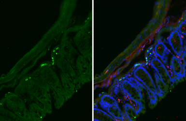 Anti-CXCR5 antibody [HL3708] used in IHC (Frozen sections) (IHC-Fr). GTX641880