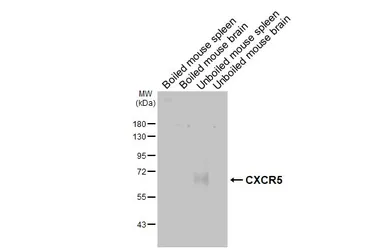 Anti-CXCR5 antibody [HL3708] used in Western Blot (WB). GTX641880