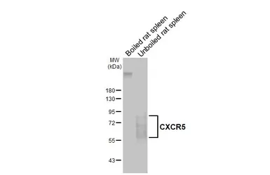 Anti-CXCR5 antibody [HL3708] used in Western Blot (WB). GTX641880