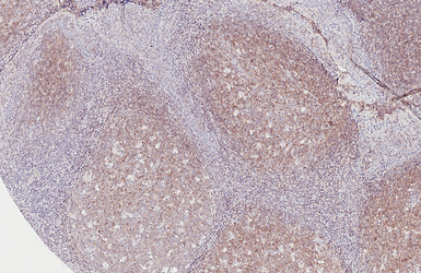 Anti-CXCR5 antibody [HL3708] used in IHC (Paraffin sections) (IHC-P). GTX641880