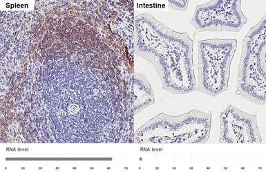 Anti-CXCR5 antibody [HL3708] used in IHC (Paraffin sections) (IHC-P). GTX641880