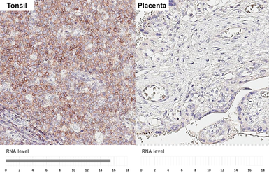 Anti-CXCR5 antibody [HL3708] used in IHC (Paraffin sections) (IHC-P). GTX641880