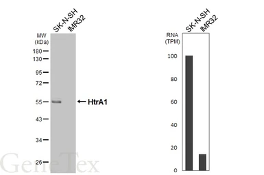 Anti-HtrA1 antibody [HL3709] used in Western Blot (WB). GTX641881