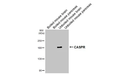 Anti-CASPR antibody [GT82] used in Western Blot (WB). GTX641887