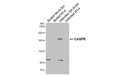 Anti-CASPR antibody [GT82] used in Western Blot (WB). GTX641887