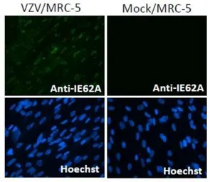 Anti-Varicella Zoster virus IE62 antibody [62A] used in Immunocytochemistry/ Immunofluorescence (ICC/IF). GTX64189