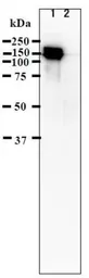 Anti-Varicella Zoster virus IE62 antibody [62A] used in Western Blot (WB). GTX64189