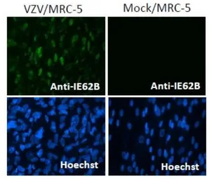Anti-Varicella Zoster virus IE62 antibody [62B] used in Immunocytochemistry/ Immunofluorescence (ICC/IF). GTX64190