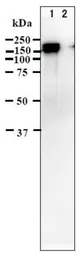 Anti-Varicella Zoster virus IE62 antibody [62B] used in Western Blot (WB). GTX64190