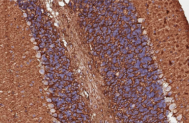 Anti-Integrin beta 1 / CD29 antibody [HL3715] used in IHC (Paraffin sections) (IHC-P). GTX641905