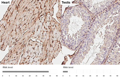 Anti-Integrin beta 1 / CD29 antibody [HL3715] used in IHC (Paraffin sections) (IHC-P). GTX641905